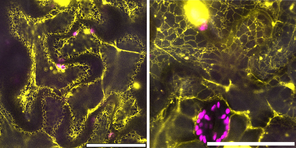 Microscopy images show protein structure within plant cells